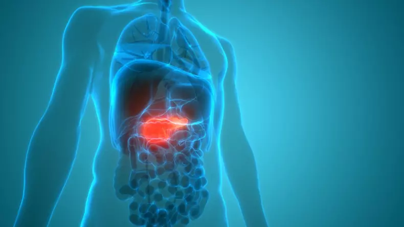 Tipul de cancer care ar putea fi depistat cu trei ani înainte să se instaleze doar prin controlul greutății și al glicemiei