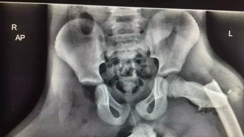 crop-accident-picioare-bord