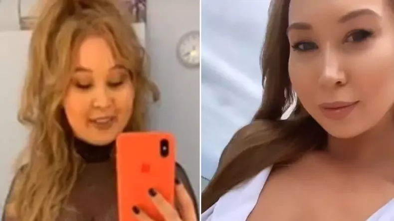 cum-arata-xonia-la-trei-luni-dupa-ce-a-aparut-cu-fata-umflata-s-a-filmat-fara-sutien_10_size24