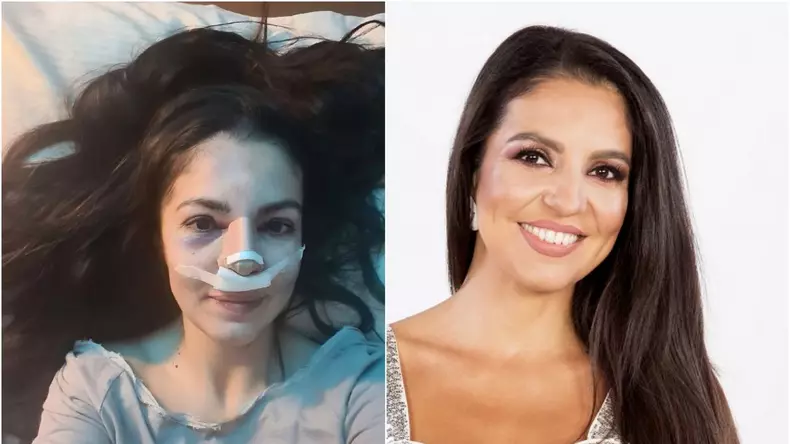 cristina-joia-a-doua-operatie-dupa-ce-a-fost-desfigurata-zcred-ca-toate-lucrurile-se-intampla-cu-un-motiv-1_4_size24