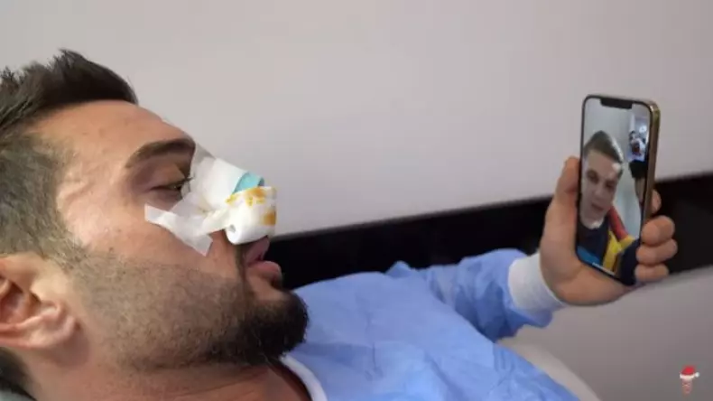 dorian-popa-face-haz-de-necaz-pe-internet-care-e-adevarul-despre-operatia-la-nas-video-493489