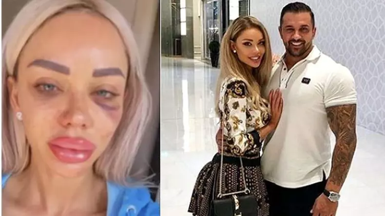 alex-bodi-scandal-bianca-dragusanu-fotografii-bataie-694745