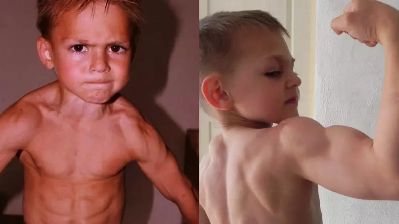 Cum-arata-Micul-Hercule-acum-13-ani-cand-a-intrat-in-Cartea-Recordurilor