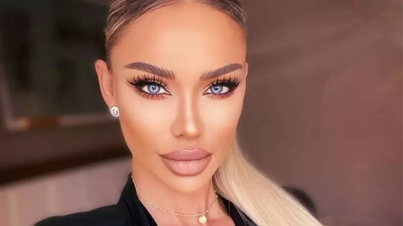 Bianca Drăgușanu, de nerecunoscut după vizita la medicul estetician