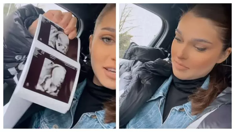 theo-rose-prima-fotografie-cu-ecografia-bebelusului-detaliul-care-i-a-atras-atentia-imediat-dupa-control-am-fost-si-l-am-vazut
