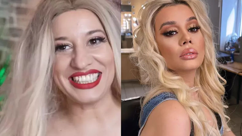 anisia-gafton-operatie-nas-1