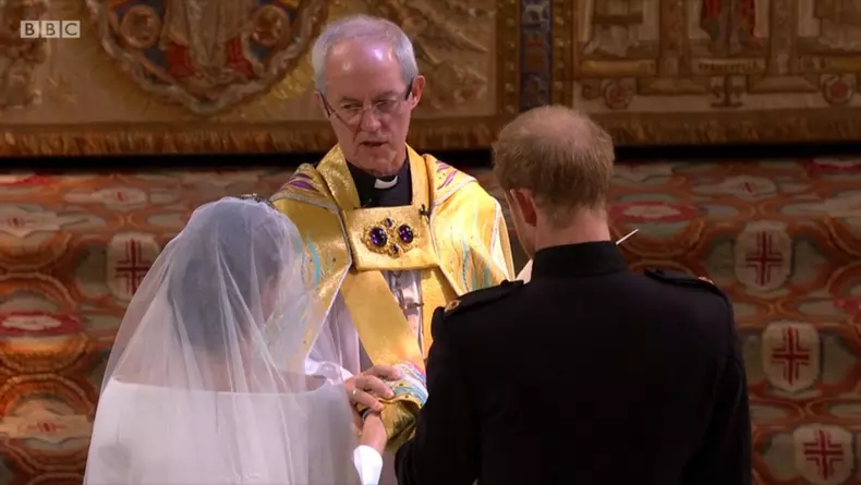 Meghan Markle îl încurajează pe Prințul Harry să apeleze la chirurgia estetică