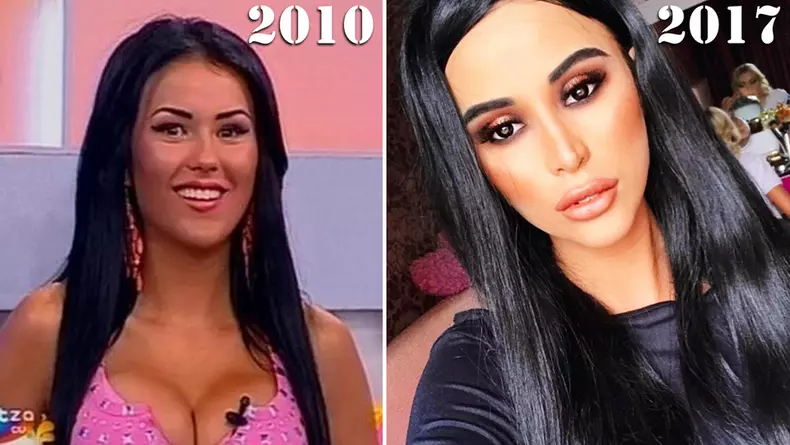 daniela inainte si dupa operatiile estetice