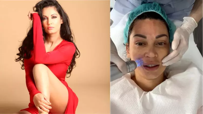 nicoleta-luciu-criticata-dupa-ce-si-a-tunat-fata-hp