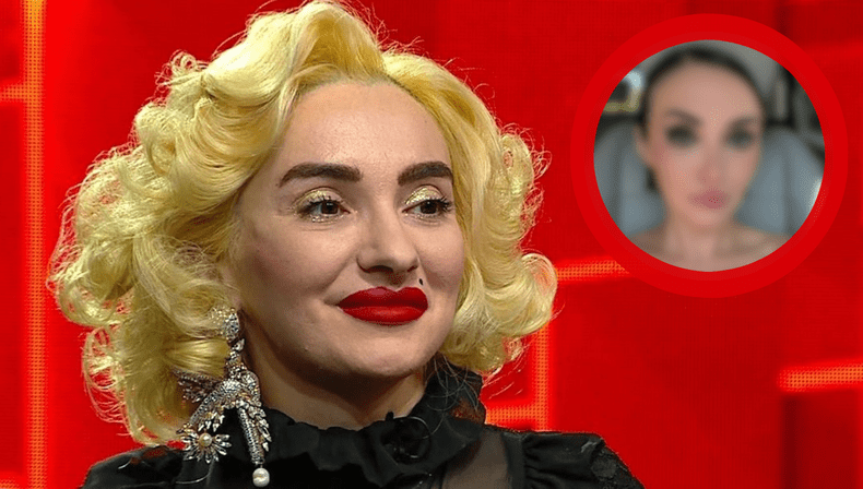 Ana Morodan, transformată complet de operațiile estetice