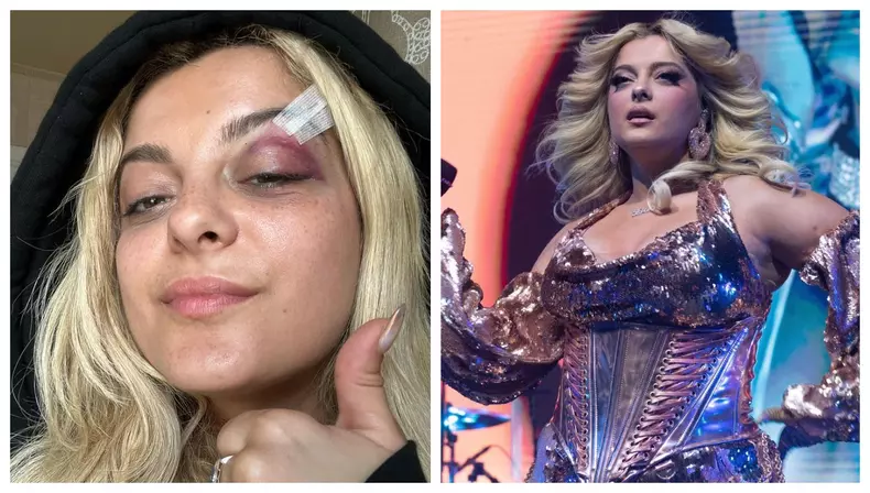 bebe-rexha-a-ajuns-la-spital-dupa-ce-a-fost-lovita-cu-un-telefon-in-ochi-1