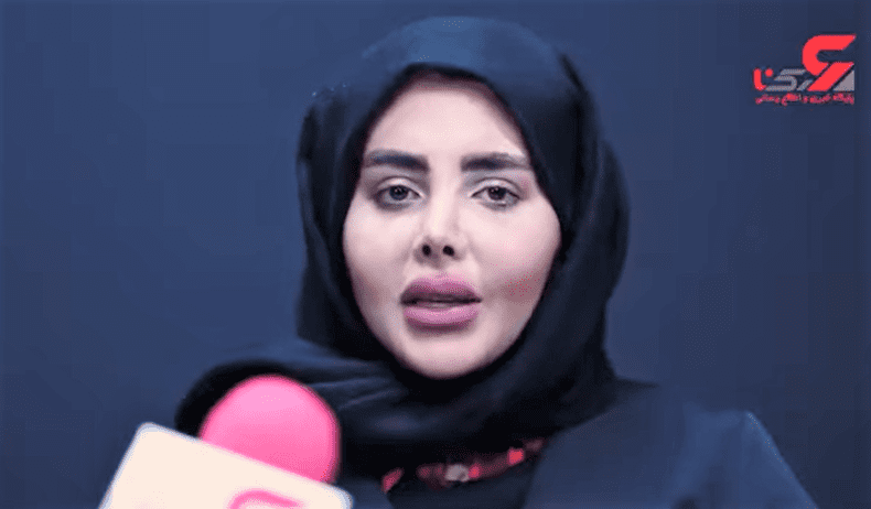 cum-arata-de-fapt-sahar-tabar-tanara-din-iran-poreclita-zombie-angelina-jolie