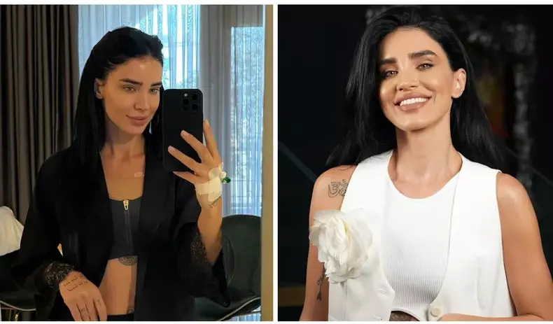 adelina-pestritu-silicoane