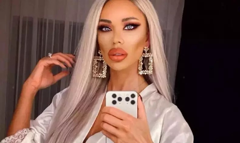 bianca-dragusanu-a-postat-fotografiile-dupa-bataia-primita-de-alex-bodi-11-840x500-2