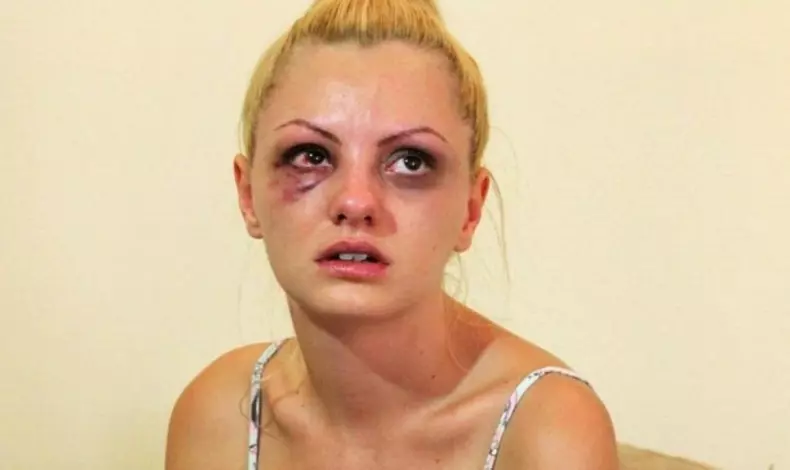 Alexandra Stan survivor bătută de iubit (2)