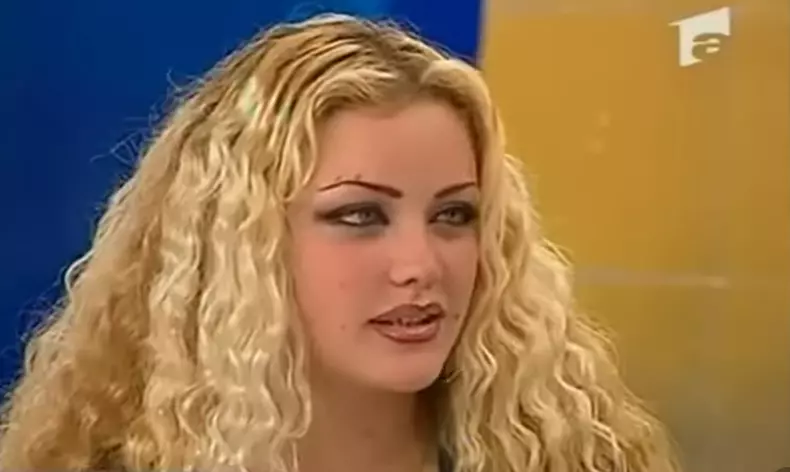 Bianca Drăgușanu înainte de operații estetice (3)