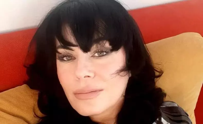 mariana moculescu interventie estetica 5