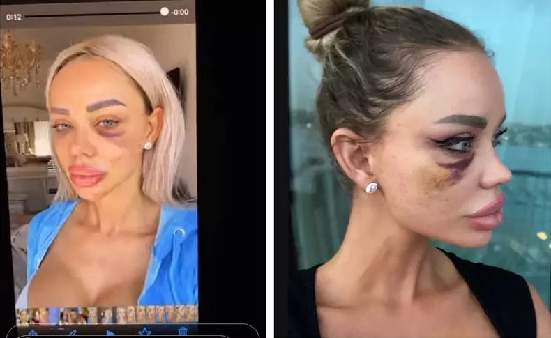 bianca-dragusanu-batuta