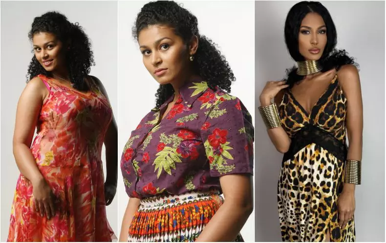 majda-si-a-facut-lipoaspiratie