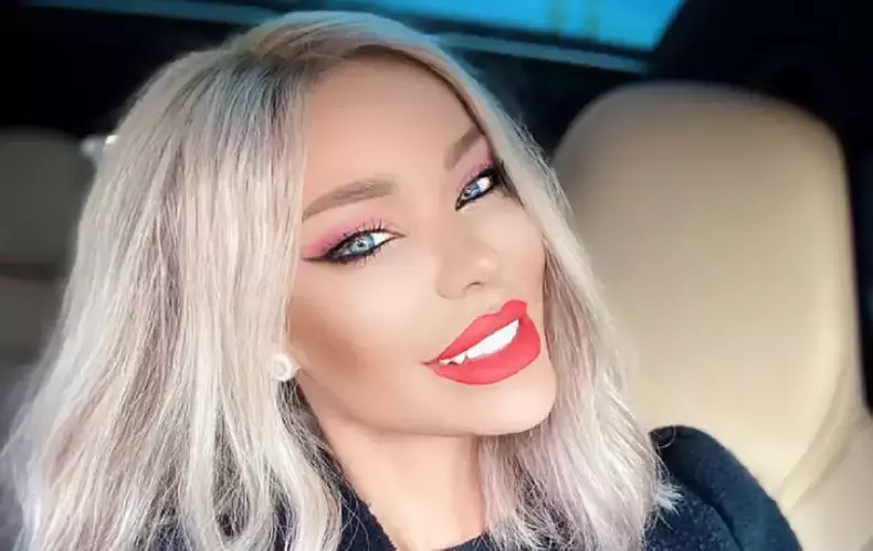 bianca-dragusanu-interventie-estetica-7