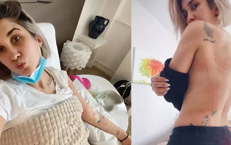 muscatura-de-capusa-adda-e1645264250830