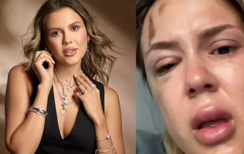 emily-burghelea-34-4