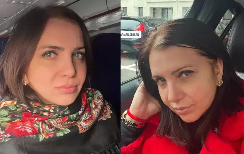 carmen-serban-complicatii-lifting