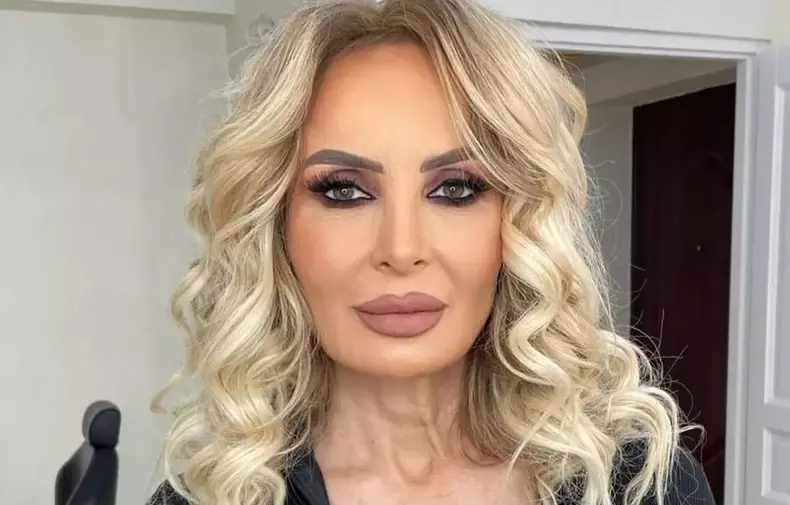 daniela-gyorfi-adevarul-despre-operatiile-estetice-2