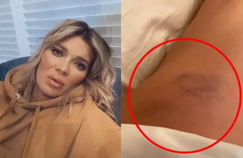 gina accident