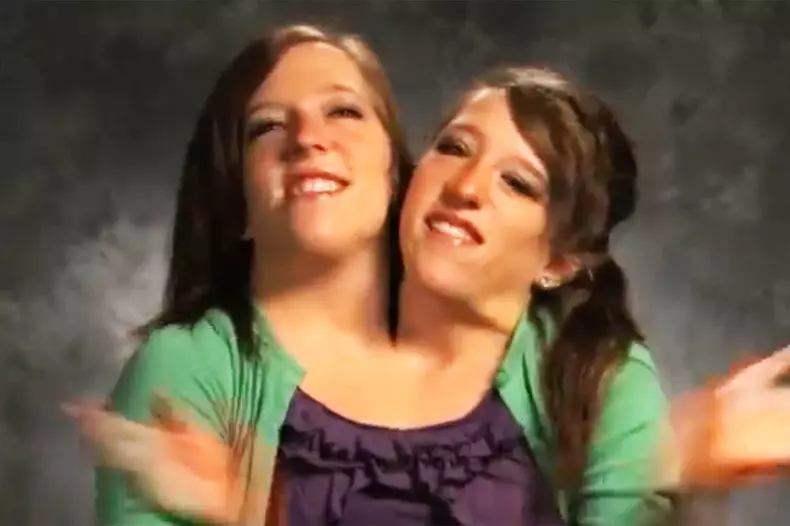 Abby and Brittany Hensel in a still from 'Abby and Brittany: Joined for Life'.