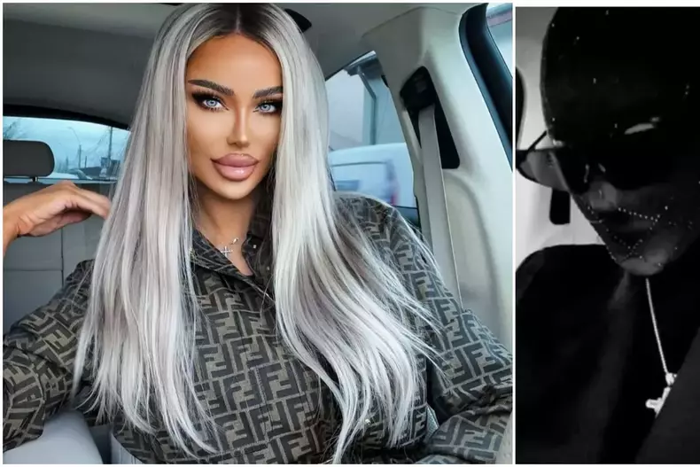 bianca-dragusanu-operatie-la-fata