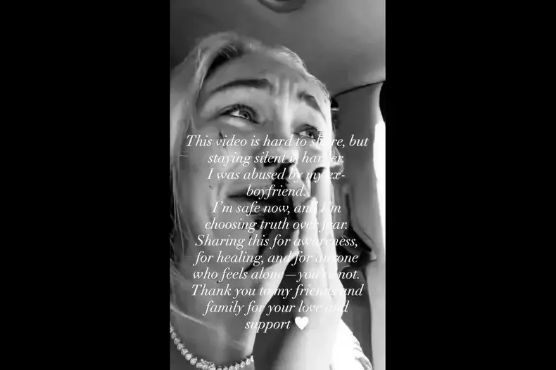 Bianca Alexandra, fostă concurentă de la „Bravo, ai stil!”, bătută de iubit (1)