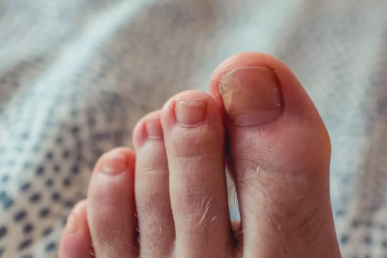 young man feet