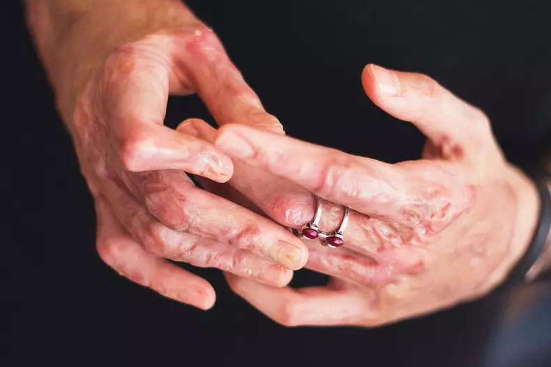 44126036_10217505220652125_5275845488904503296_o