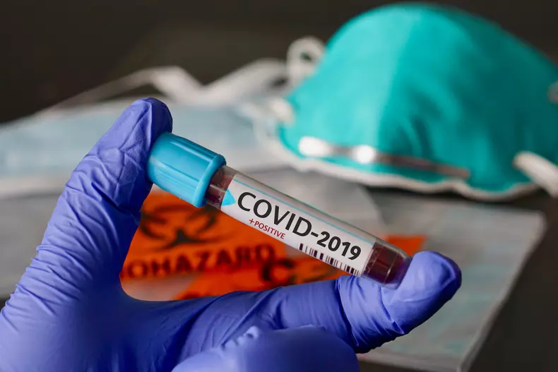 Coronavirus-COVID-19-nCoV-2019-23-of-23-33