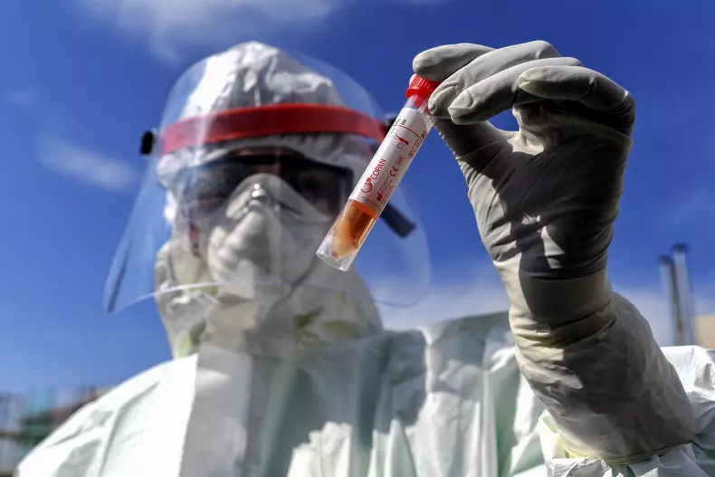 Doctor of the Giugliano Hospital show the test tube - Italy