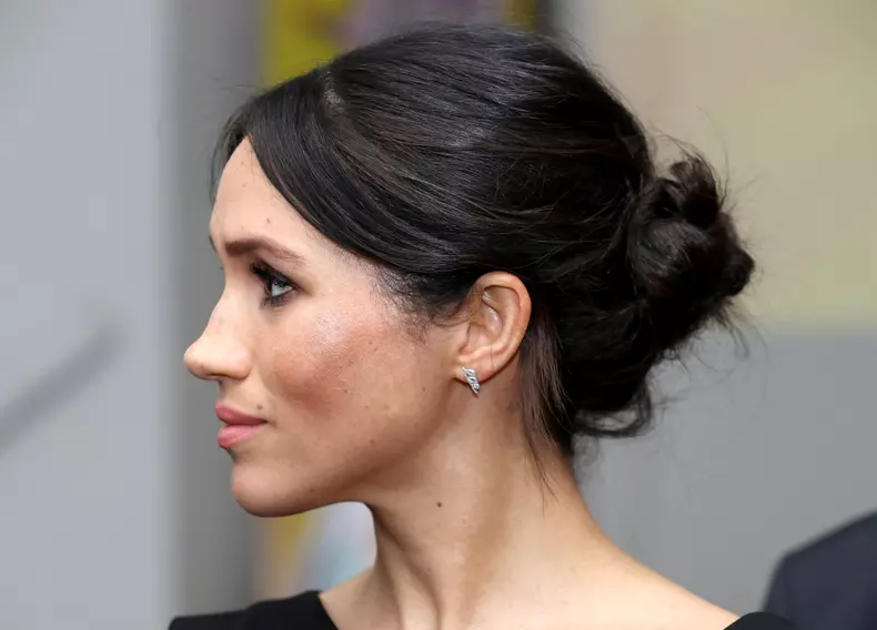 Nasul perfect, dar... imperfect al lui Meghan.