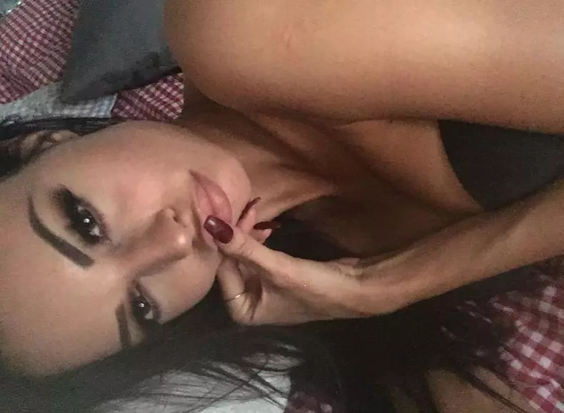 Justyna-operatii-estetice-5