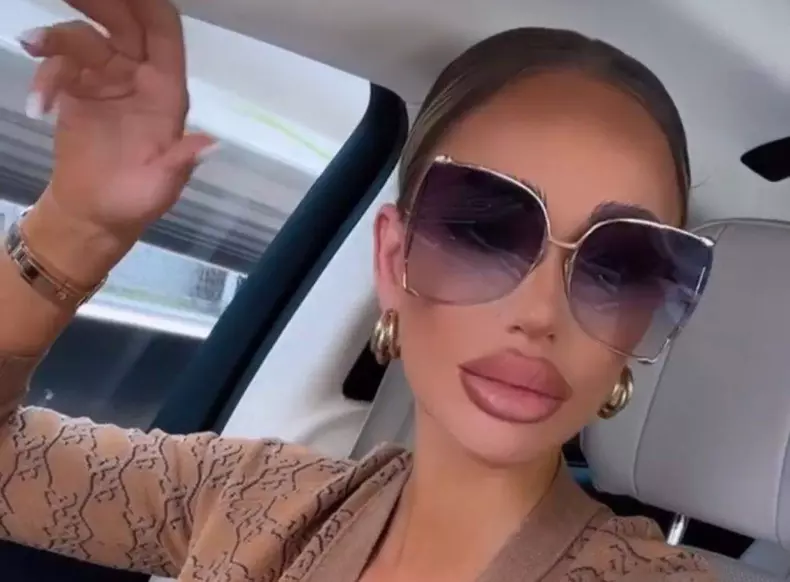 bianca dragusanu si-a schimbat forma buzelor