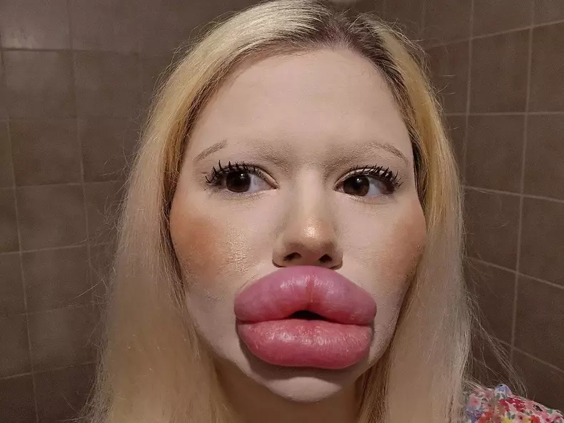 andrea