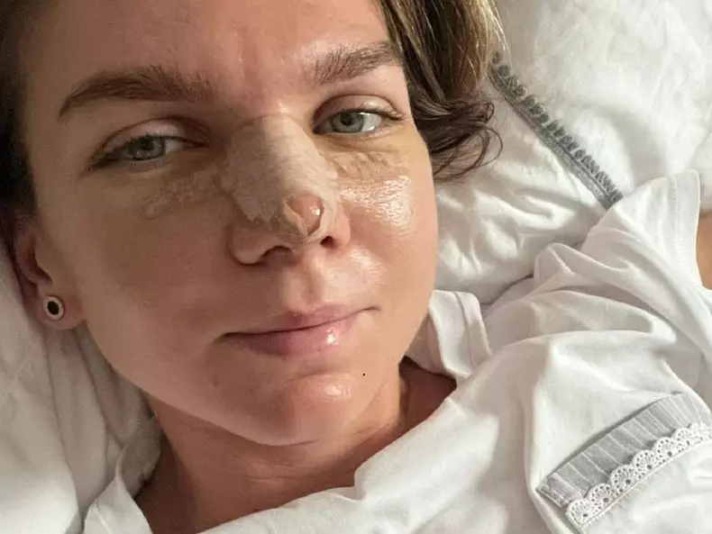 simona-halep-operatie-nas