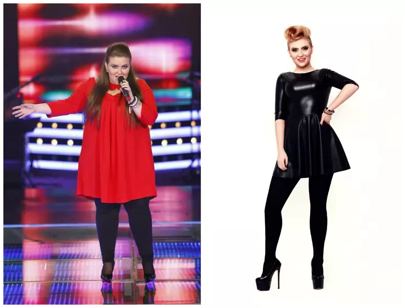 oana radu operatii estetice slabit