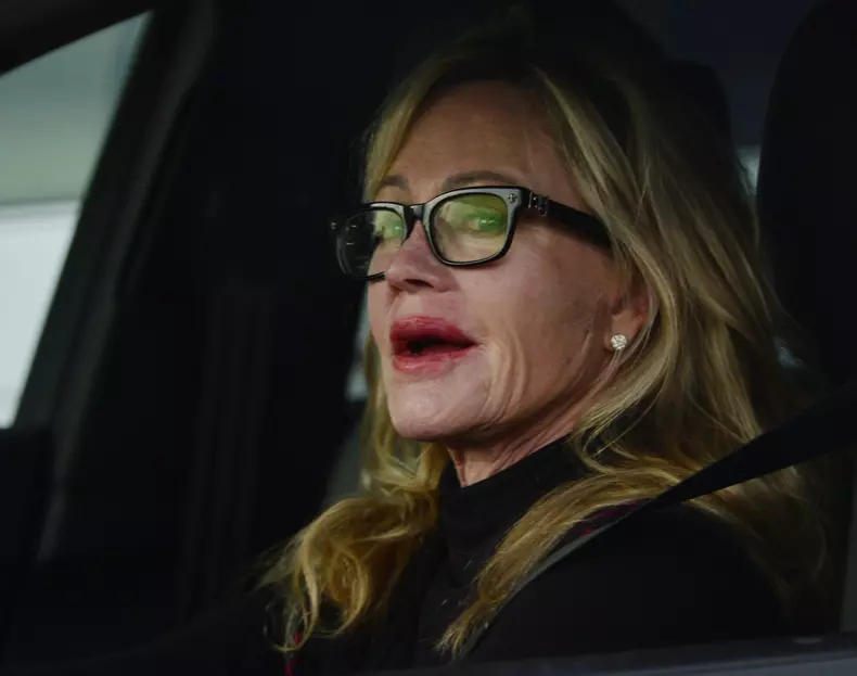 EXCLUSIVE: Melanie Griffith, Star Of 'Nip/Tuck' Displays Recent Scar On The Left Side Of Her Face As She Is Spotted In West Hollywood, CA
