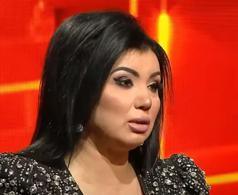 adriana-bahmuteanu-operatii-estetice-3