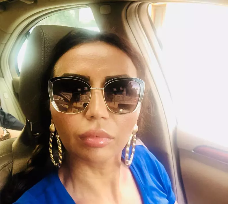 Narcisa Guta şi-a făcut peste 20 de operaţii estetice