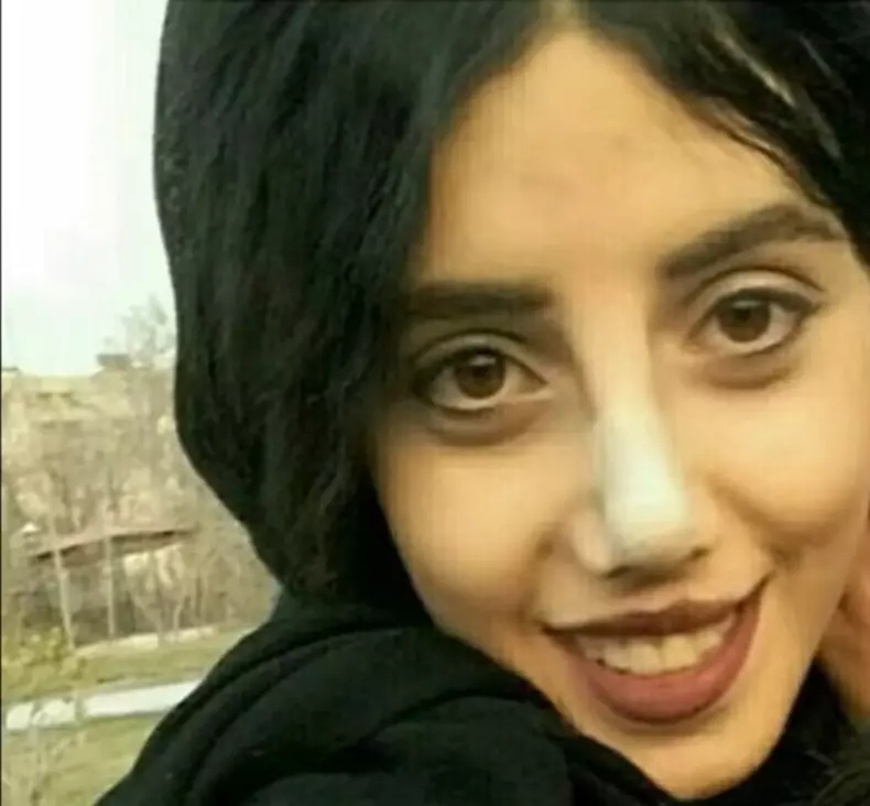 cum-arata-sahar-tabar-inainte-de-cele-50-de-operatii-estetice-11