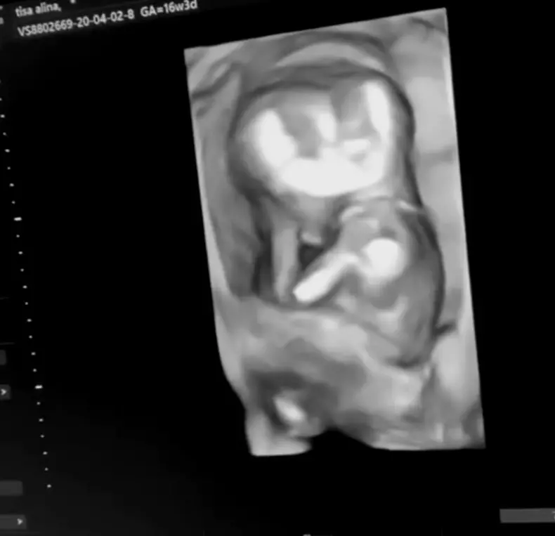 Alina-Ceușan-este-însărcinată