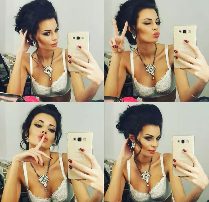 Justyna-operatii-estetice-3