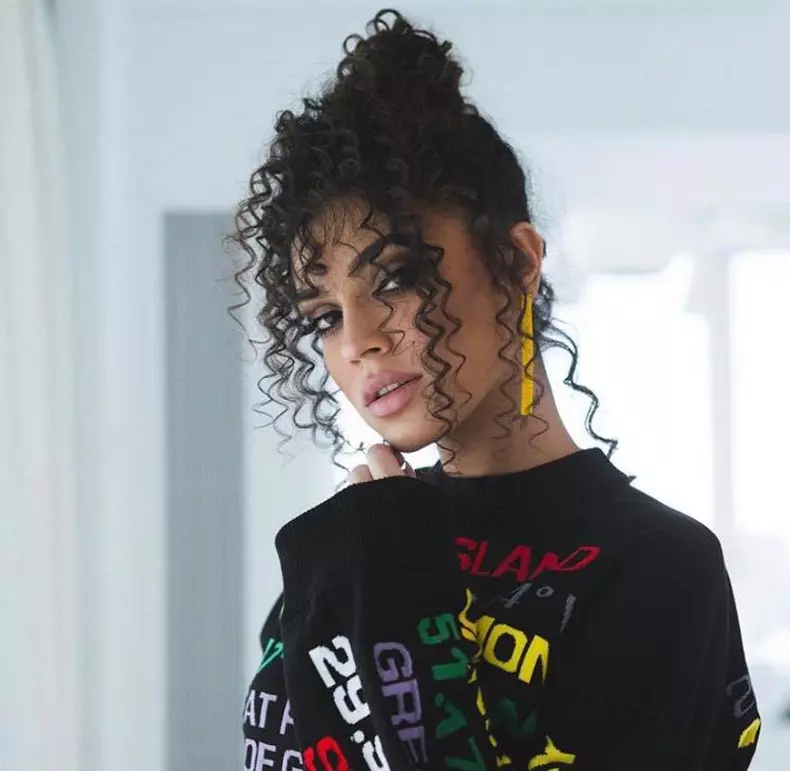 Karmen-prima-intervenție-estetică-5