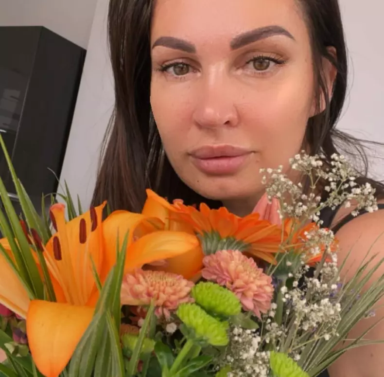 nicoleta luciu interventii estetice la fata (3)